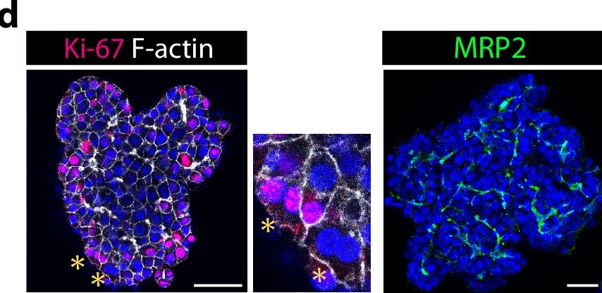 Fig.1.D showing Immunohistochemistry-immunofluorescence in a Homo sapiens (Human) sample from the publication: Mapping of mitogen and metabolic sensitivity in organoids defines requirements for human hepatocyte growth.