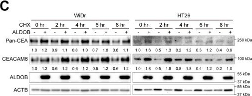 Fig.6.C showing Western Blotting from the publication: Aldolase B-driven lactagenesis and CEACAM6 activation promote cell renewal and chemoresistance in colorectal cancer through the Warburg effect.