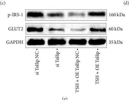 Fig.5.C showing Western Blotting from the publication: Thyroid-Stimulating Hormone Regulates the Glucose Metabolism in Hepatocytes via Toll-Like Receptor 4/Tollip Pathway.