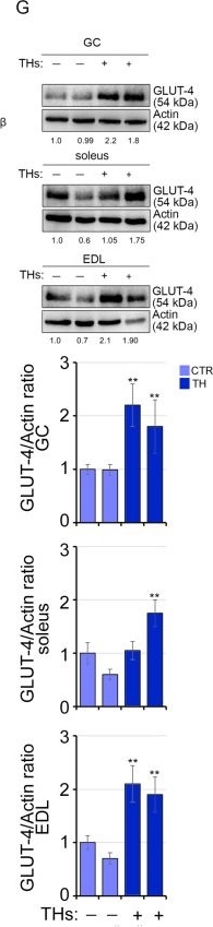 Fig.7.G showing Western Blotting in a Mus musculus (House mouse) sample from the publication: Thyroid Hormone Regulates the Lipid Content of Muscle Fibers, Thus Affecting Physical Exercise Performance.