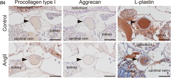 Fig.3.B showing Immunohistochemistry in a Danio rerio (Zebrafish) sample from the publication: Microinjection of angiotensin II into zebrafish embryos induces transient dilation and elastin disruption of the dorsal aorta.