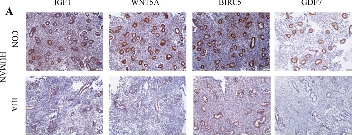Fig.6.A showing Immunohistochemistry from the publication: Immune-related hub genes in intrauterine adhesions: a bioinformatics approach.