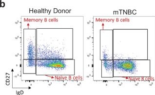 Fig.3.B showing Flow cytometry/Cell sorting in a Homo sapiens (Human) sample from the publication: Triple-negative breast cancer modifies the systemic immune landscape and alters neutrophil functionality.