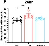 Fig.7.F from the publication: Regulated cell death and inflammasome activation in gut injury following traumatic surgery in vitro and in vivo: implication for postoperative death due to multiorgan dysfunction.