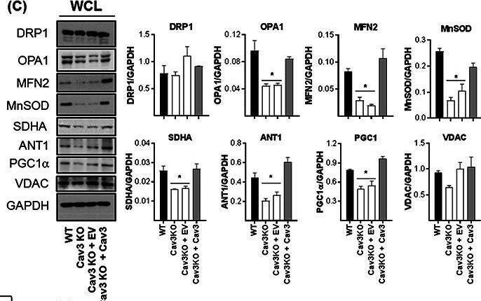 Fig.7.C showing Western Blotting from the publication: Caveolin-3 deficiency associated with the dystrophy P104L mutation impairs skeletal muscle mitochondrial form and function.