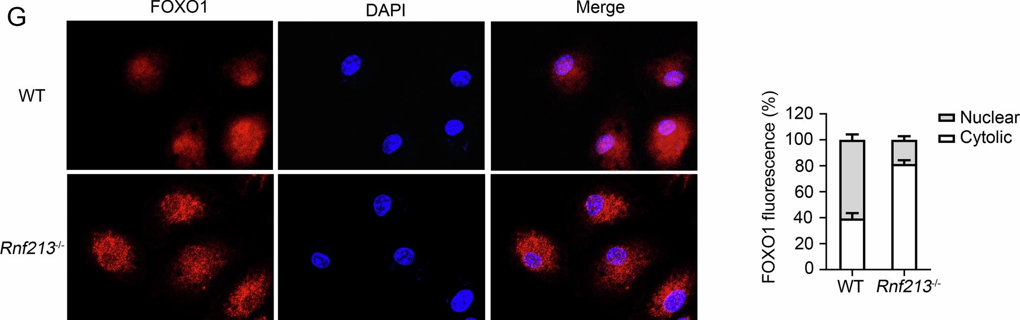 Fig.4.G showing Immunocytochemistry-immunofluorescence from the publication: RNF213 promotes Treg cell differentiation by facilitating K63-linked ubiquitination and nuclear translocation of FOXO1.