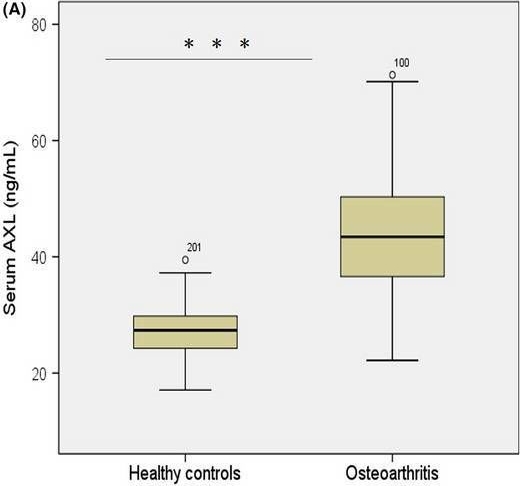 Fig.1.A showing Enzyme-linked immunosorbent assay from the publication: Increased serum AXL is associated with radiographic knee osteoarthritis severity.
