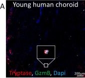 Fig.2.A showing Immunohistochemistry-immunofluorescence from the publication: Granzyme B from mast cells contributes to choroidal neovascularization in a model of wet age-related macular degeneration.