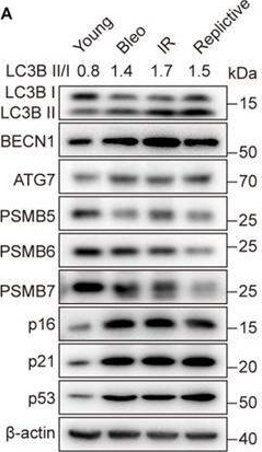 Fig.3.A showing Western Blotting from the publication: Asparaginase and Autophagy Inhibitors Effectively Remove Senescent Cells by Synergistically Limiting Asparagine Supply.