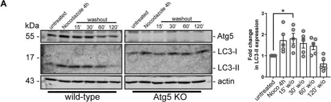 Fig.7.A showing Western Blotting in a Homo sapiens (Human) sample from the publication: Loss of the Essential Autophagy Regulators FIP200 or Atg5 Leads to Distinct Effects on Focal Adhesion Composition and Organization.