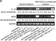 Fig.2.C showing Western Blotting from the publication: BAG3 promotes pancreatic ductal adenocarcinoma growth by activating stromal macrophages.