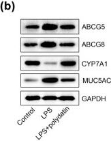 Fig.5.B showing Western Blotting from the publication: Polydatin prevents cholesterol gallstone formation by regulating cholesterol metabolism via PPAR-γ signaling.
