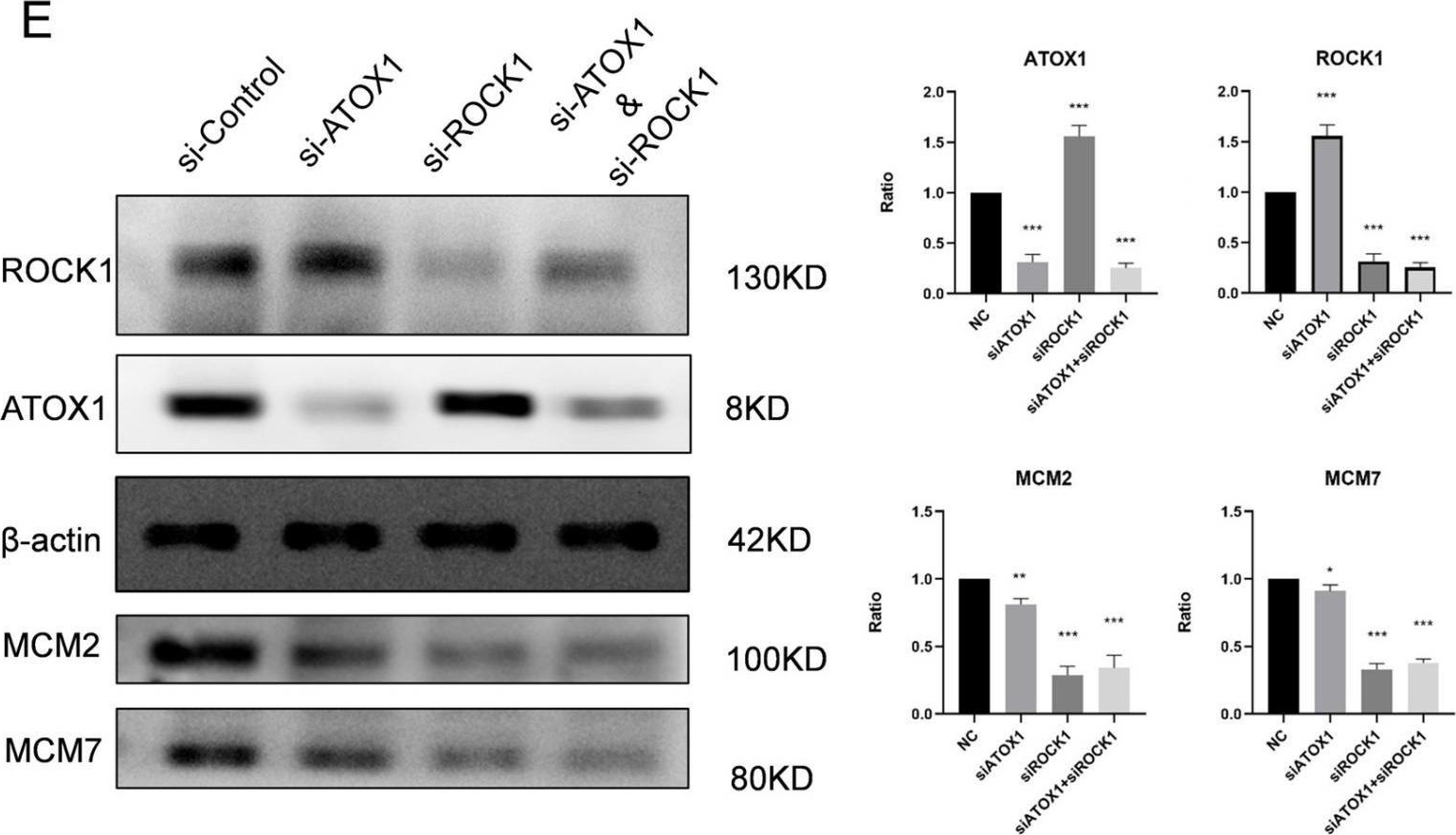 Fig.3.E showing Western Blotting in a Homo sapiens (Human) sample from the publication: Dual-Targeting of ATOX1 and ROCK1: A Potent Strategy to Potentiate the Inhibition of Lung Adenocarcinoma Proliferation.