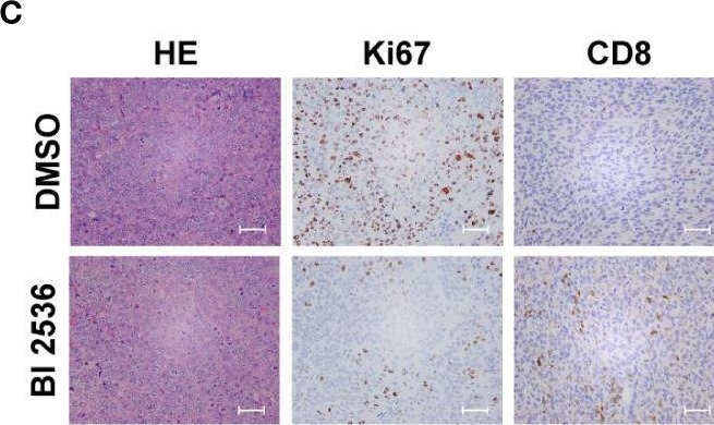 Fig.5.C showing Immunohistochemistry from the publication: BI 2536 induces gasdermin E-dependent pyroptosis in ovarian cancer.