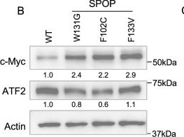 Fig.3.B showing Western Blotting in a Homo sapiens (Human) sample from the publication: Divergent roles of SPOP and CHD1 in ACSL4 regulation reveal context-dependent vulnerabilities for targeting ferroptosis.
