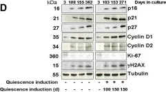 Fig.3.D showing Western Blotting in a Homo sapiens (Human) sample from the publication: Long-term quiescent fibroblast cells transit into senescence.