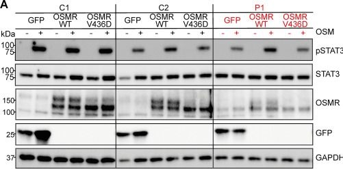 Fig.6.A showing Western Blotting from the publication: Oncostatin M receptor deficiency as a novel candidate genetic cause of autosomal recessive hyper-IgE syndrome.