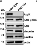Fig.5.A showing Western Blotting in a Homo sapiens (Human) sample from the publication: Loss of the Essential Autophagy Regulators FIP200 or Atg5 Leads to Distinct Effects on Focal Adhesion Composition and Organization.