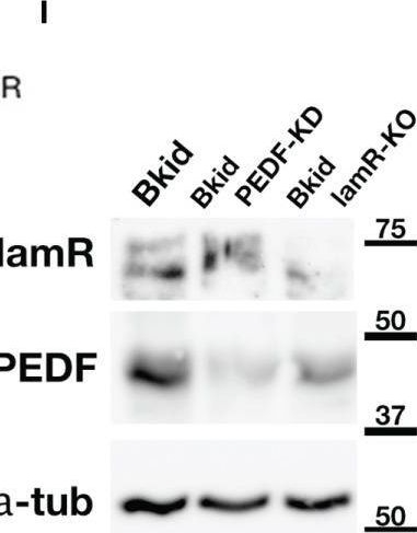 Fig.5.Y showing Western Blotting from the publication: Pigment Epithelium Derived Factor Is Involved in the Late Phase of Osteosarcoma Metastasis by Increasing Extravasation and Cell-Cell Adhesion.