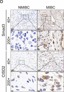 Fig.7.O showing Immunohistochemistry from the publication: Targeting the SMAD3/CISD2 axis suppresses bladder cancer progression by promoting ferroptosis in mesenchymal-like bladder cancer cells.