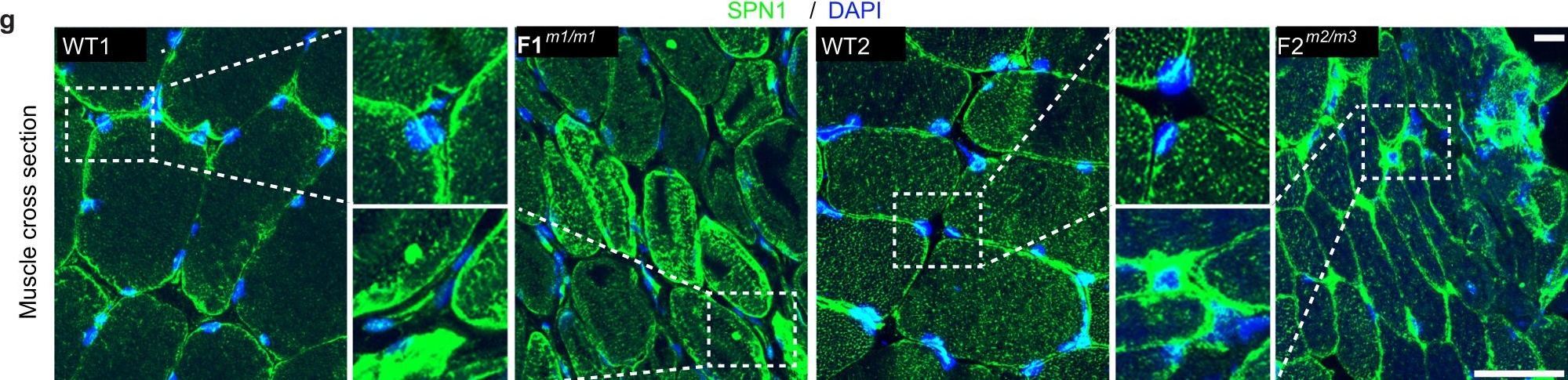 Fig.2.G showing Immunohistochemistry-immunofluorescence from the publication: SNUPN deficiency causes a recessive muscular dystrophy due to RNA mis-splicing and ECM dysregulation.