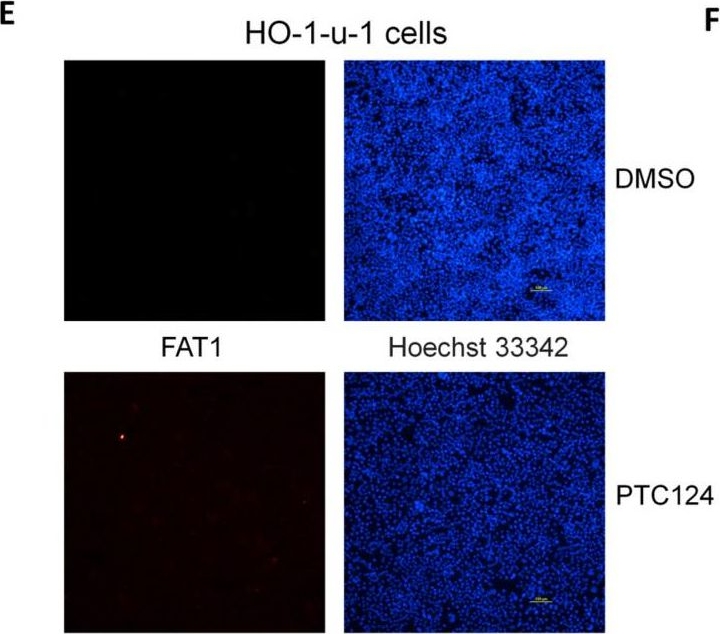 Fig.2.E showing Immunocytochemistry-immunofluorescence in a Homo sapiens (Human) sample from the publication: PTC124 Rescues Nonsense Mutation of Two Tumor Suppressor Genes NOTCH1 and FAT1 to Repress HNSCC Cell Proliferation.