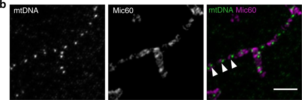 ER-mitochondria contacts promote mtDNA nucleoids active transportation via mitochondrial dynamic tubulation.