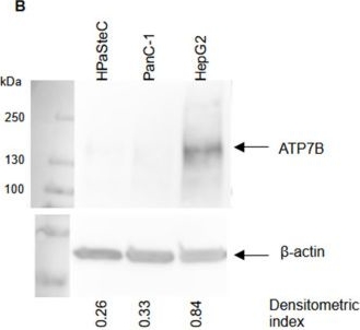 Fig.2.B showing Western Blotting in a Homo sapiens (Human) sample from the publication: Investigation of the Putative Relationship Between Copper Transport and the Anticancer Activity of Cisplatin in Ductal Pancreatic Adenocarcinoma.