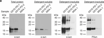 Fig.1.A showing Western Blotting from the publication: The G51D SNCA mutation generates a slowly progressive α-synuclein strain in early-onset Parkinson's disease.