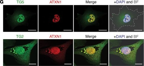 Fig.4.G showing Immunocytochemistry-immunofluorescence in a Homo sapiens (Human) sample from the publication: Cross-species genetic screens identify transglutaminase 5 as a regulator of polyglutamine-expanded ataxin-1.
