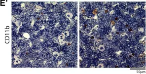 Fig.4.E showing Immunohistochemistry in a Rattus norvegicus (Rat) sample from the publication: The impact of chronic intermittent hypoxia on hematopoiesis and the bone marrow microenvironment.