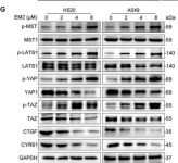 YAP/TAZ (D24E4) Rabbit Monoclonal Antibody | Cell Signaling Technology