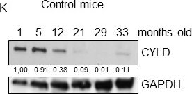 Fig.5.K showing Western Blotting in a Mus musculus (House mouse) sample from the publication: Premature aging and cancer development in transgenic mice lacking functional CYLD.