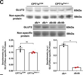 Fig.7.C showing Western Blotting in a Mus musculus (House mouse) sample from the publication: Pancreatic expression of CPT1A is essential for whole body glucose homeostasis by supporting glucose-stimulated insulin secretion.