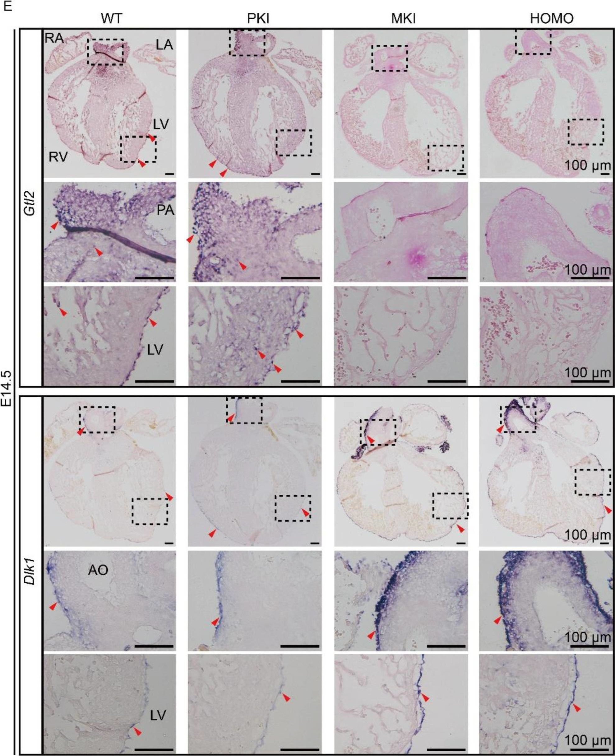 Fig.3.E showing Immunohistochemistry in a Mus musculus (House mouse) sample from the publication: LncRNAs in the Dlk1-Dio3 Domain Are Essential for Mid-Embryonic Heart Development.