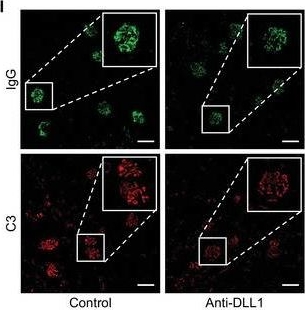 Fig.7.I showing Immunohistochemistry-immunofluorescence in a Mus musculus (House mouse) sample from the publication: Group 3 Innate Lymphoid Cells Exacerbate Lupus Nephritis by Promoting B Cell Activation in Kidney Ectopic Lymphoid Structures.