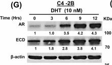 Fig.1.G showing Western Blotting from the publication: ECD, a novel androgen receptor target promotes prostate cancer tumorigenesis by regulating glycolysis.