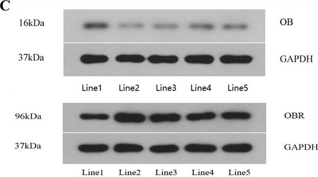 Fig.4.C showing Western Blotting in an Ovis aries (Sheep) sample from the publication: Presence of leptin and its receptor in the ram reproductive system and in vitro effect of leptin on sperm quality.