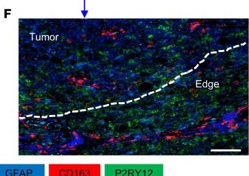 Fig.2.F showing Immunohistochemistry-immunofluorescence from the publication: Dual targeting macrophages and microglia is a therapeutic vulnerability in models of PTEN-deficient glioblastoma.