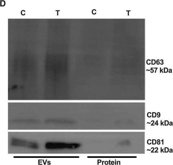 Fig.3.D showing Western Blotting from the publication: Endoplasmic reticulum stress alters myelin associated protein expression and extracellular vesicle composition in human oligodendrocytes.