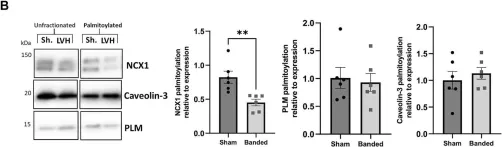 Fig.2.B showing Western Blotting from the publication: Dynamic but discordant alterations in zDHHC5 expression and palmitoylation of its substrates in cardiac pathologies.