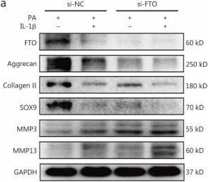 Fig.2.A showing Western Blotting in a Mus musculus (House mouse) sample from the publication: Downregulation of FTO aggravates osteoarthritis with obesity by erasing m6A methylation of PDP2.