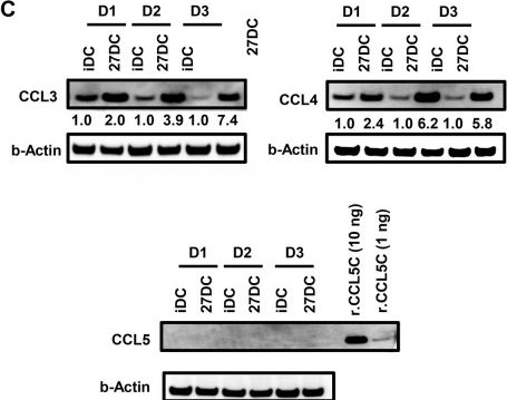 Fig.7.C showing Western Blotting in a Homo sapiens (Human) sample from the publication: Interleukin-27-induced HIV-resistant dendritic cells suppress reveres transcription following virus entry in an SPTBN1, autophagy, and YB-1 independent manner.