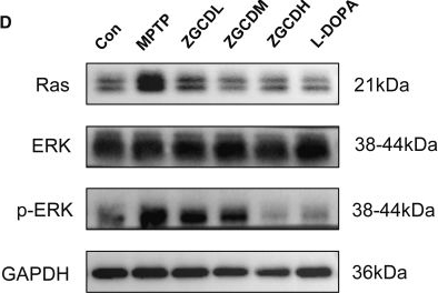 Fig.6.D showing Western Blotting from the publication: Zhigancao decoction alleviates Parkinson's disease via inhibiting TNF/NF-κB and Ras/ERK-mediated neuroinflammation and apoptosis.