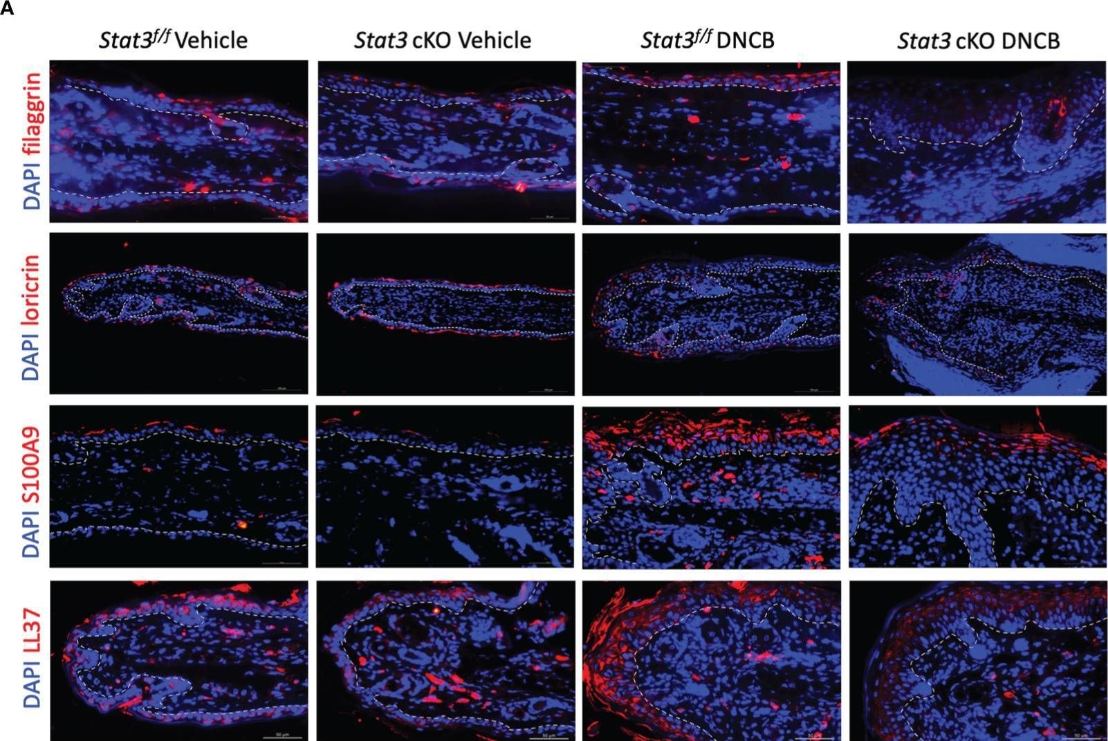 Fig.2.A showing Immunohistochemistry-immunofluorescence in a Mus musculus (House mouse) sample from the publication: Epidermal keratinocyte-specific STAT3 deficiency aggravated atopic dermatitis-like skin inflammation in mice through TSLP upregulation.