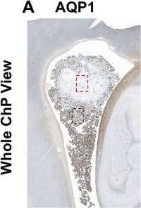 Fig.3.A showing Immunohistochemistry in an Equus caballus (Horse) sample from the publication: Choroid plexus and perivascular space abnormalities in CerTra syndrome: neuroimaging and histological findings.