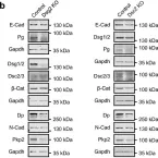 Fig.3.B showing Western Blotting in a Mus musculus (House mouse) sample from the publication: Adhesion of pancreatic tumor cell clusters by desmosomal molecules enhances early liver metastases formation.