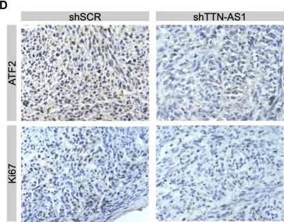 Fig.4.D showing Immunohistochemistry in a Homo sapiens (Human) sample from the publication: Targeting Long Non-Coding RNA TTN-AS1 Suppresses Bladder Cancer Progression.