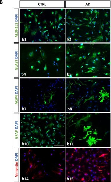 Fig.1.B showing Immunocytochemistry-immunofluorescence from the publication: Human iPSC-derived APOE4/4 Alzheimer´s disease astrocytes exhibit a senescent and pro-inflammatory state that compromises neuronal support.