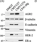 Fig.1.A showing Western Blotting from the publication: AGR2-mediated unconventional secretion of 14-3-3ε and α-actinin-4, responsive to ER stress and autophagy, drives chemotaxis in canine mammary tumor cells.